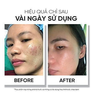 Collagen làm giảm nguy cơ lão háo da Lá House Gluta Q10 (6.5g*30gói)