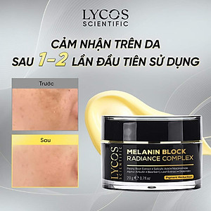 Combo 3 - Sáng Da Mờ Nám Lycos : Tinh chất Peel Da Lycos + Kem Nám Đêm Lycos + Dưỡng ẩm Lycos