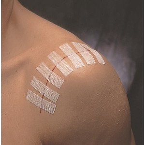 Set 3 vỉ 30 miếng dán thay chỉ khâu da 3M Steri-strip™ R1546 – Size 6mm x 100mm | Sản xuất tại Mỹ