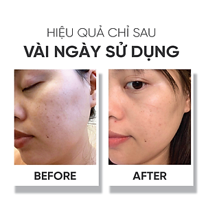 Tinh chất dưỡng trắng da Lá House Astalock Concentrated Essence 15ml/30ml