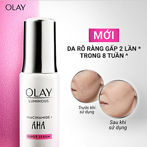 Siêu Tinh Chất Ngừa Lão Hóa OLAY Luminous Niacinamide Kết Hợp AHA 30ML