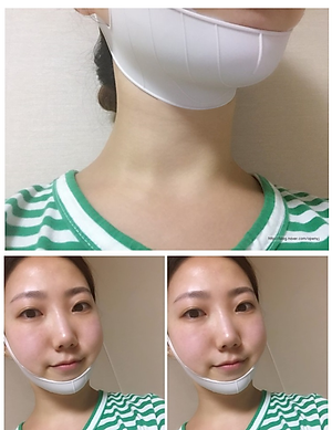 Đai It's Well Plus 4D Định Hình Khuôn Mặt Chữ V - Loại 1 (V-line)