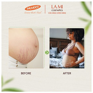 Kem ngăn ngừa và phục hồi rạn da giữa thai kỳ Palmer's 125g