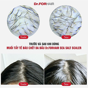 Muối tẩy tế bào chết, làm sạch da đầu Dr.FORHAIR Sea Salt Scaler 300g