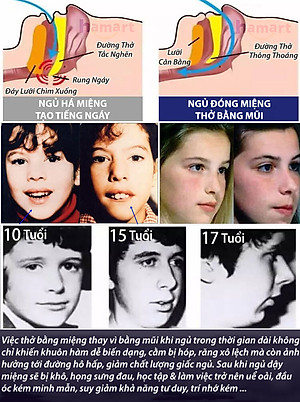 Gói 30 Miếng Dán Chống Há Miệng Khi Ngủ Giảm Ngáy Mouth Seal Băng Dính Miệng Người Lớn Trẻ Em