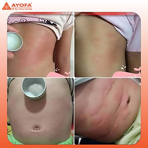 Cao Xoa Bóp Massage Thảo Dược Giúp Phục Hồi Và Làm Dịu Nhanh Chóng Ayofa Relax Hương Chanh 60G