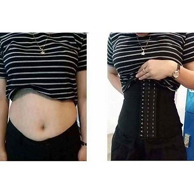 Ngọc Châu lộ rõ da bụng sần sùi khi diện đồ hở phẫu thuật múi bụng