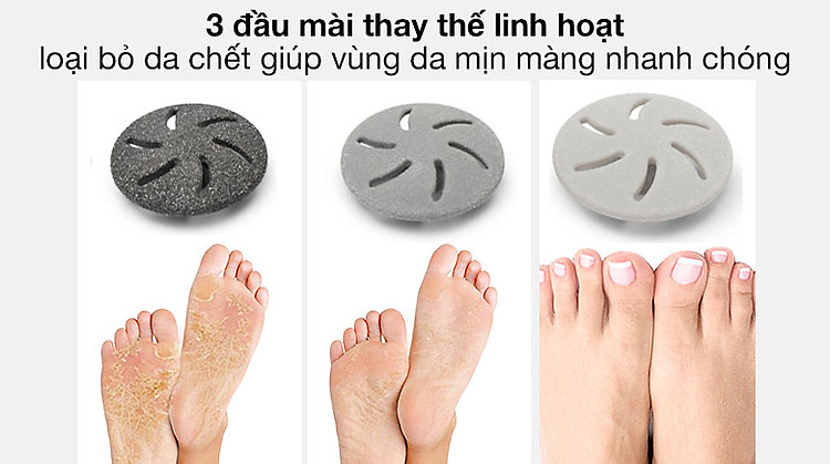 3 đầu thay thế linh hoạt - Máy tẩy da chết gót chân Rio PEDI3