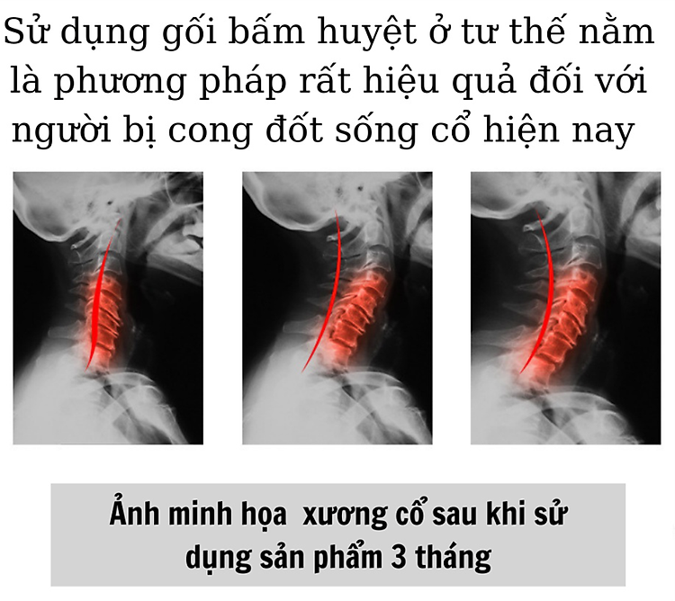 goi-massage-co-vai-gay-bam-huyet-chong-moi-co-mua-hang-chinh-hang-tai-supermall-1.png?v=1666155722731