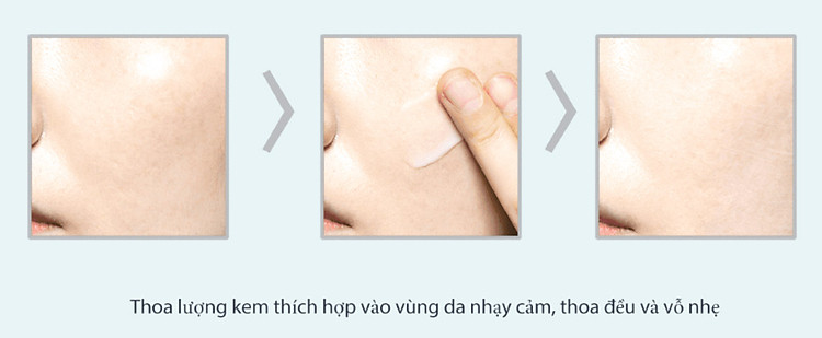 kem dưỡng ẩm da lov kin cica repair cream dành cho da mụn, da bị kích ứng - 100g 2
