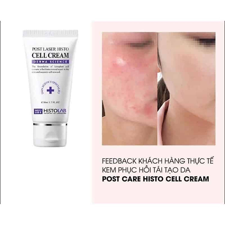Post care histo cell cream