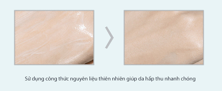 kem dưỡng ẩm da lov kin cica repair cream dành cho da mụn, da bị kích ứng - 100g 1