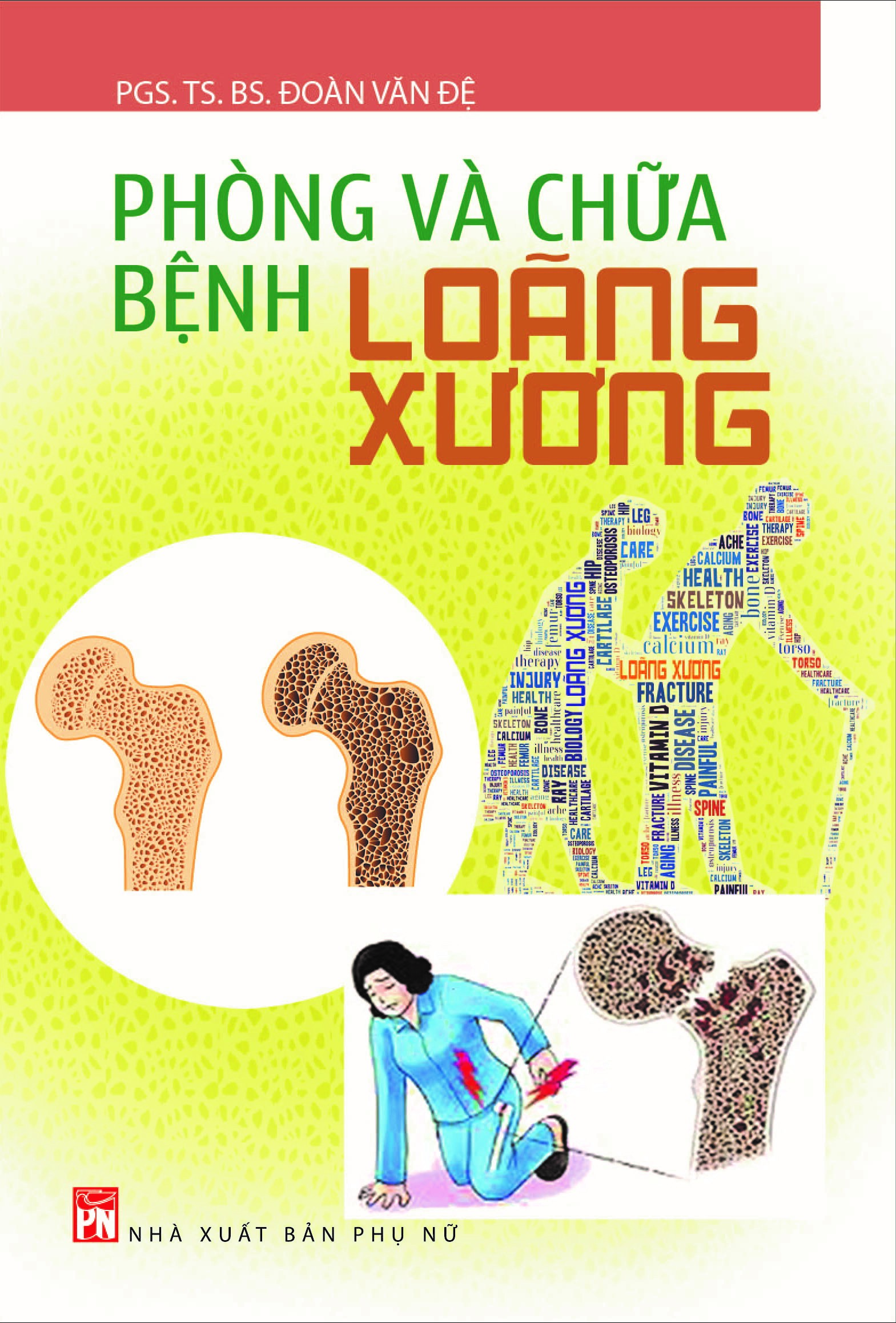 Phòng Và Chữa Bệnh Loãng Xương