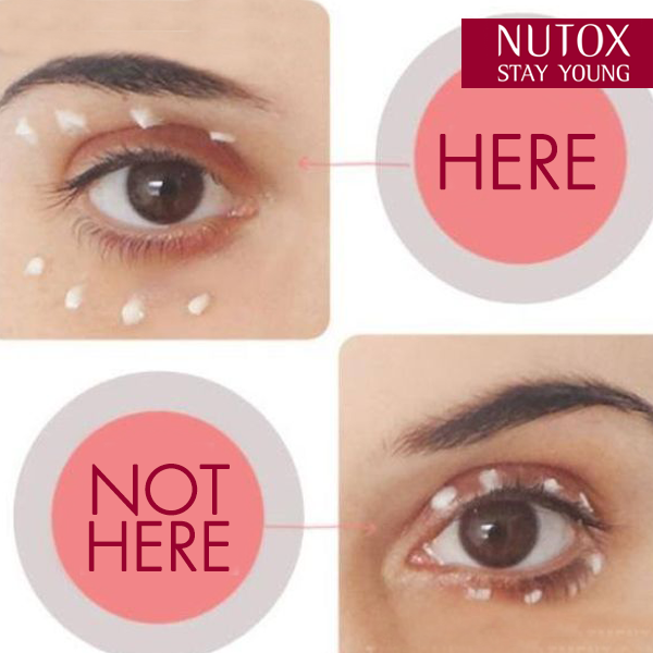 Kem dưỡng và chống nhăn vùng mắt thương hiệu Nutox 15ml