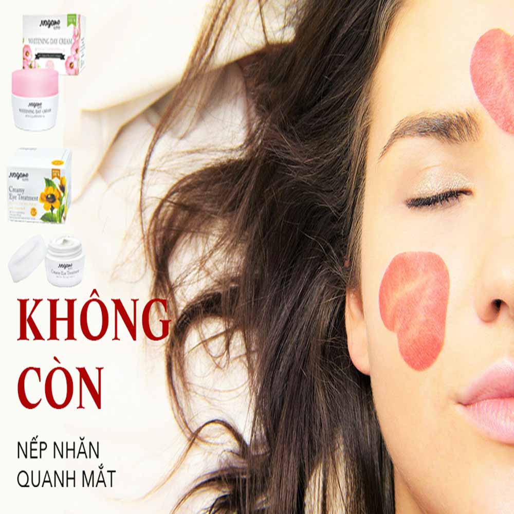 Combo Kem Dưỡng Trắng Da Ban Ngày Và Kem Trẻ Hóa Da Vùng Mắt Nagano Japan - Whitening Day Cream & Creamy Eye Treatment - Bộ đôi ngăn ngừa mụn đầu đen, tàn nhang, giảm quầng thâm và nếp nhăn quanh mắt
