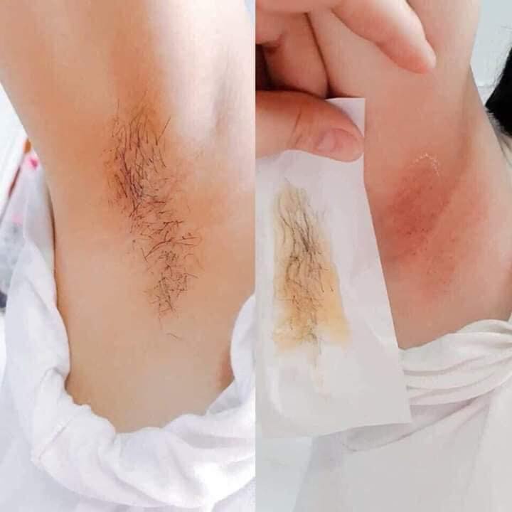 Combo Triệt Lông, Trị Thâm Mỡ Trăn N'store - Wax Lông Với Thành Phần Tự Nhiên Shiny