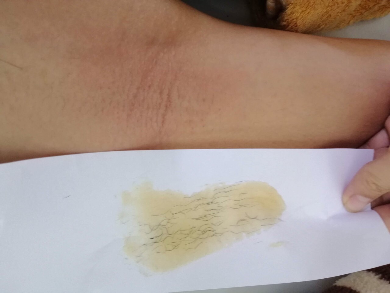 Combo Triệt Lông, Trị Thâm Mỡ Trăn N'store - Wax Lông Với Thành Phần Tự Nhiên Shiny