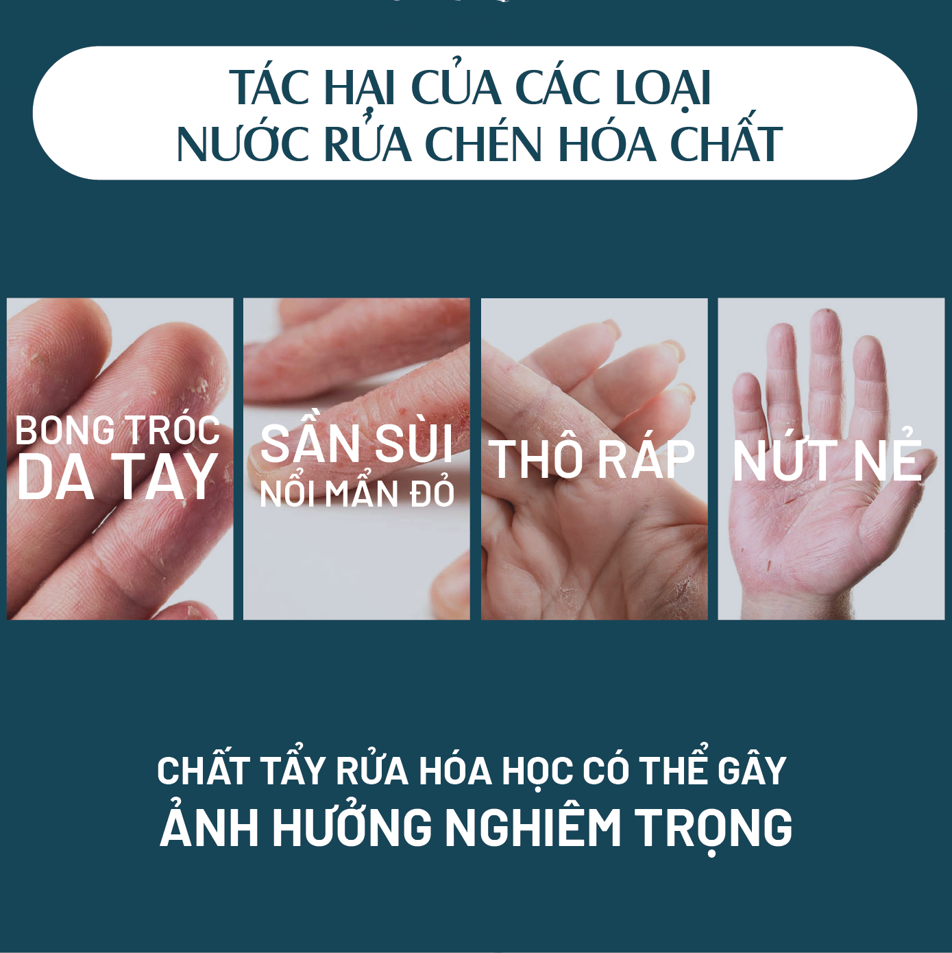 Nước rửa chén tinh dầu thảo mộc PK 300ml - Bưởi