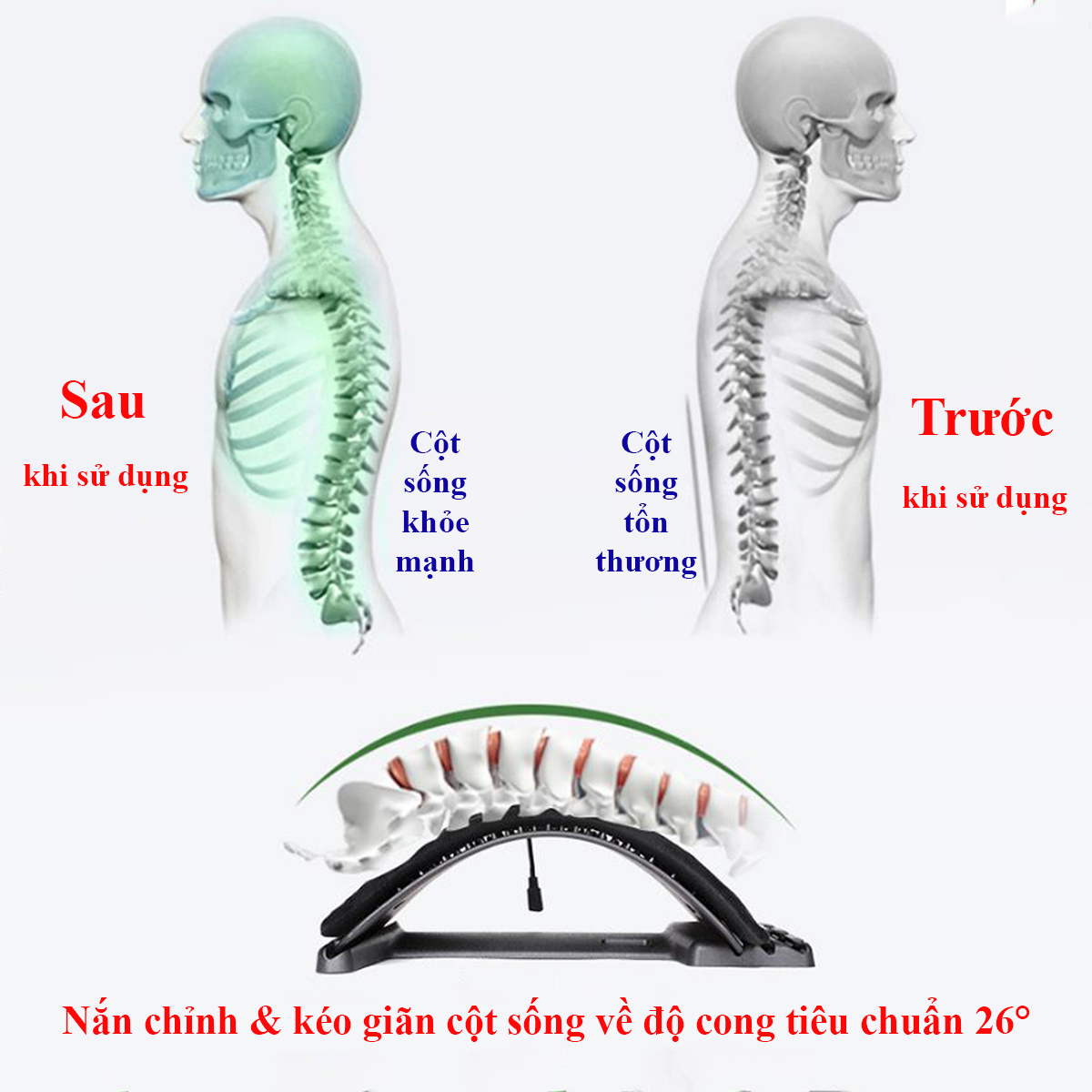 Khung Nắn Chỉnh Cột Sống, Kết Hợp Đệm Sưởi Nhiệt - Kéo Giãn Đốt Sống Lưng, Hỗ Trợ Thoái Hóa Đốt Sống Lưng, Thoát Vị Đĩa Đệm - 3 Chế Độ Nhiệt &amp; Hẹn Giờ - Hàng Chính Hãng.