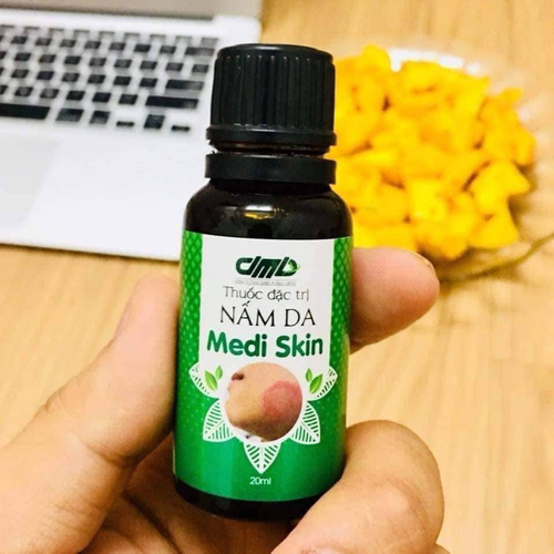 Hỗ trợ trị nấm da Medi Skin Tinh Chất Phục Hồi Giảm Ngứa Rát Vùng Da Do Nấm Từ Thảo Dược 20ml