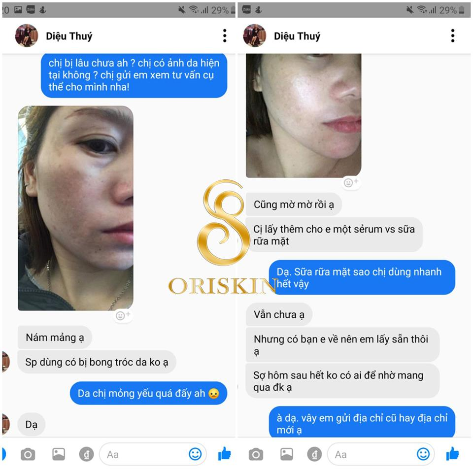 Kem Hỗ Trợ Trị Nám Tàn Nhang Oriskin Melasma