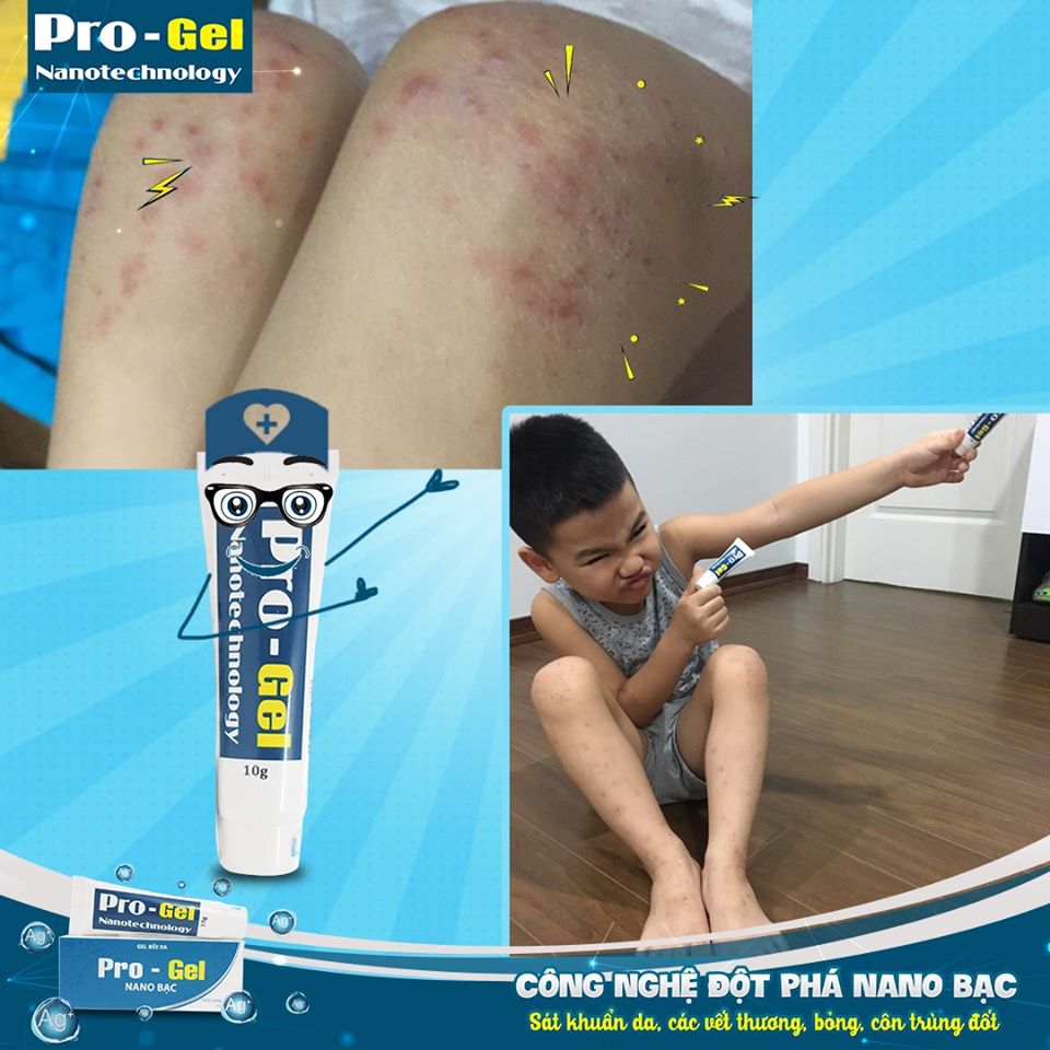 Gel Bôi Bỏng, Hăm Da, Tay Chân Miệng, Mụn Nhọt, Côn Trùng Đốt, Rôm Sảy, Zona, Thủy Đậu Pro - Gel Nano Bạc