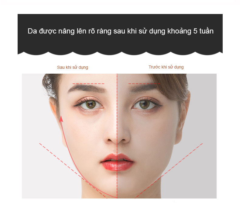 Máy Massge Mặt Di Điện RF Nâng Cơ, Thúc Đẩy  Collagen, Tăng Cường Hấp Thụ Dưỡng Chất, Kết Hợp 6 Loại Ánh Sáng Sinh Học Giúp Trẻ Hóa Da K-SKIN - Cao Cấp Chính Hãng