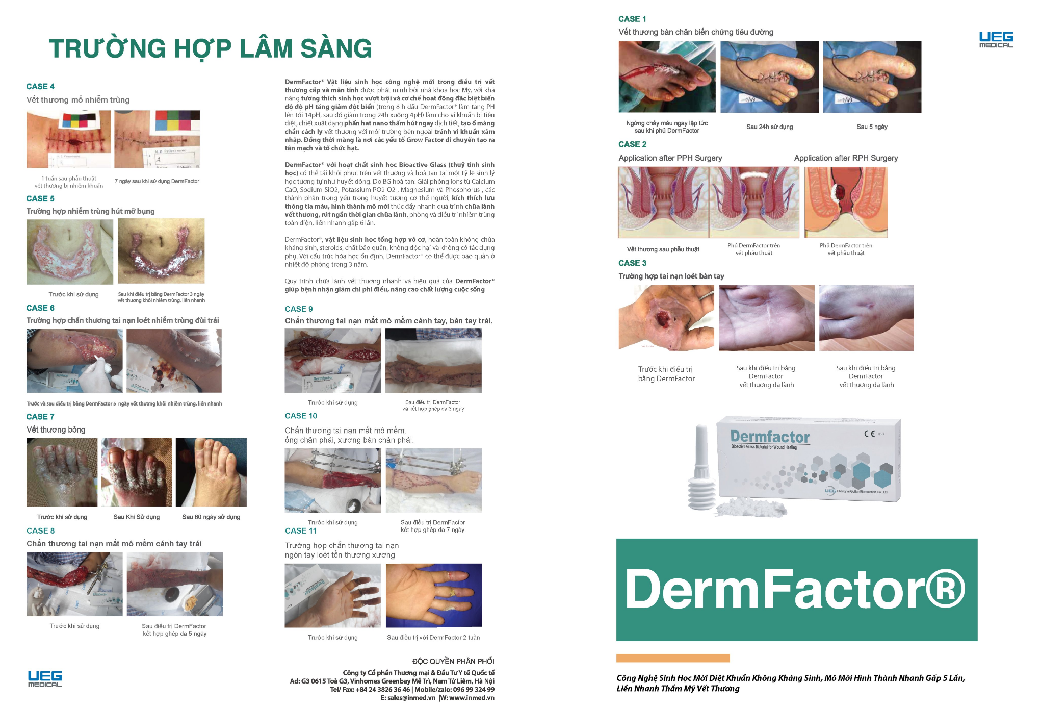 DermFactor Liền Nhanh Vết Thương Cấp và Mãn Tính Nhanh Gấp 5 Lần, Thẩm Mỹ Tránh Sẹo