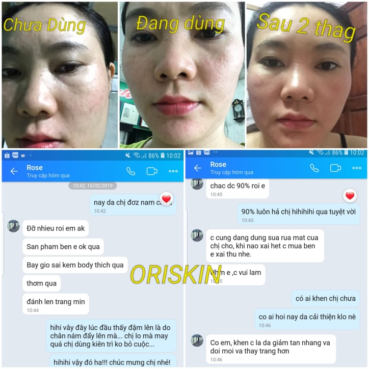 Kem Hỗ Trợ Trị Nám Tàn Nhang Oriskin Melasma