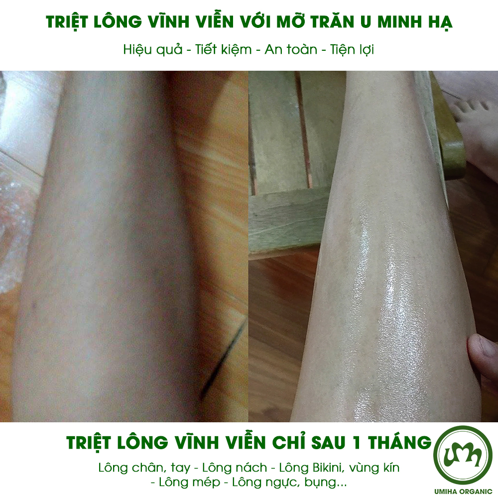 Combo tẩy triệt lông Chân Tay vĩnh viễn UMIHA tại nhà | Mỡ trăn triệt lông vĩnh viễn U Minh Hạ (30ml) &amp; Kem tẩy lông UMIHA (65ml) an toàn cho da nhạy cảm