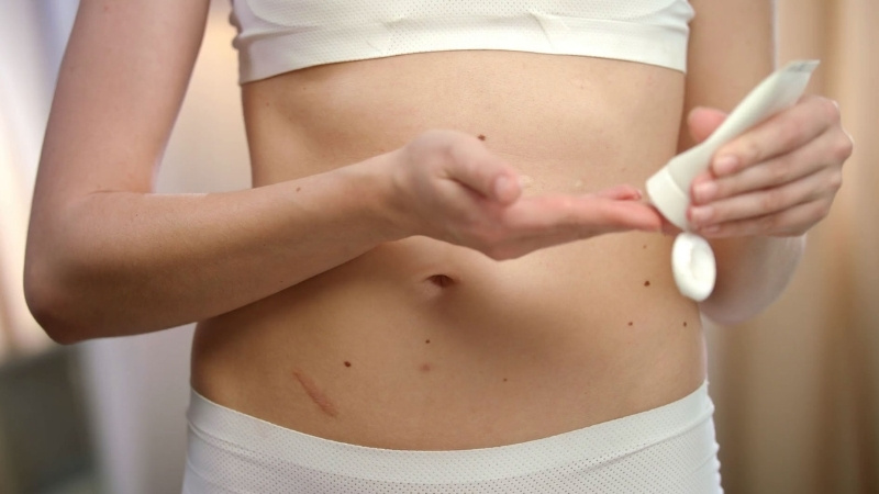 Tiki cung cấp kem tan mỡ ch&iacute;nh h&atilde;ng gi&uacute;p giảm mỡ thừa, săn chắc da v&agrave; định h&igrave;nh v&oacute;c d&aacute;ng