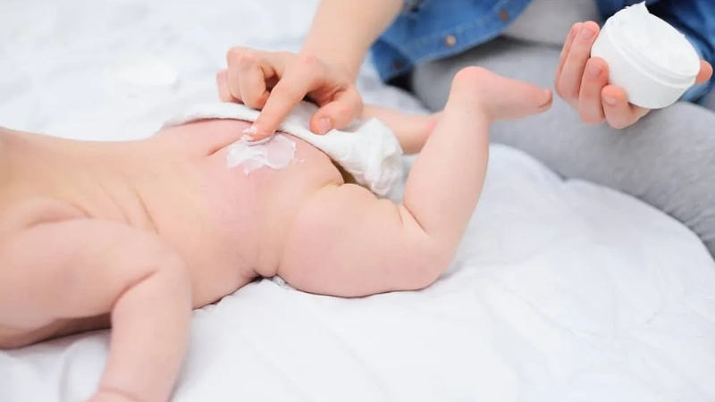 Chọn kem chống hăm cần th&agrave;nh phần an to&agrave;n, thương hiệu uy t&iacute;n, kết cấu v&agrave; hạn d&ugrave;ng