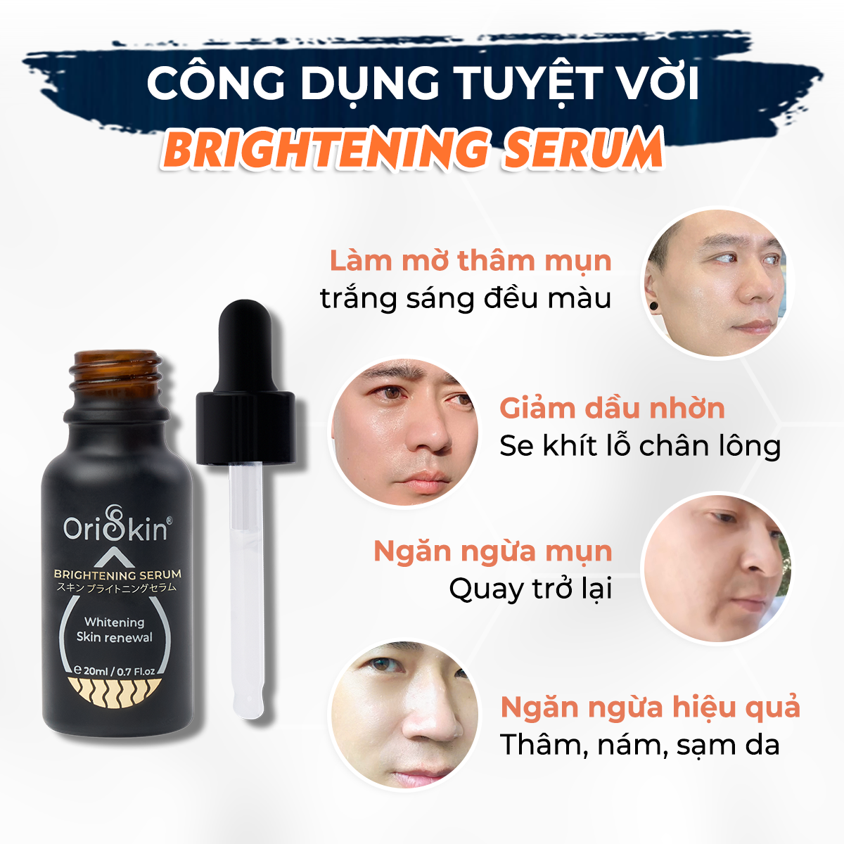 Serum Dành Cho Nam Giới Dưỡng Trắng Mờ Thâm Mụn, Kiềm Dầu, Se Khít Lỗ Chân Lông, Oriskin Brightening Serum 20 ml