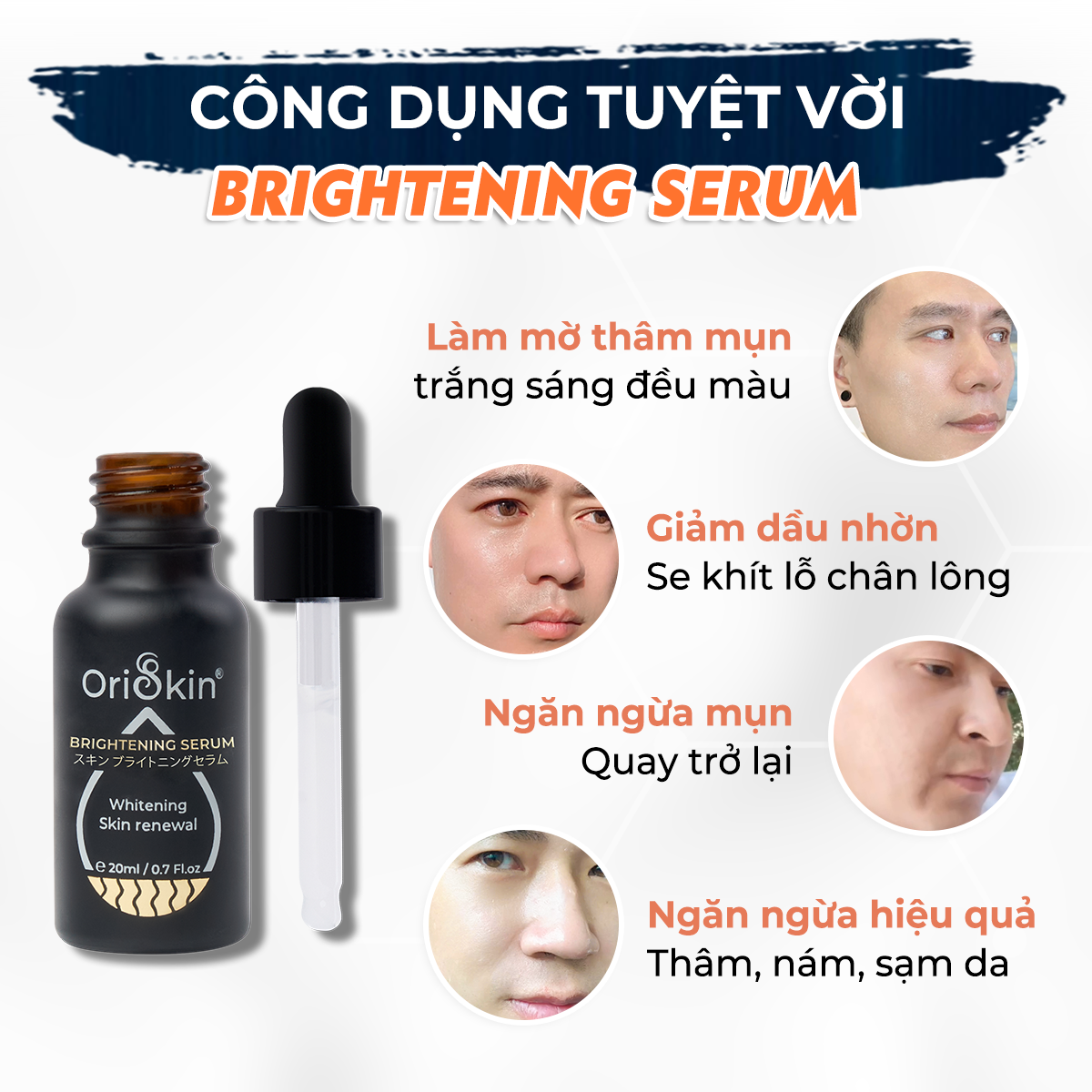 Serum Dành Cho Nam Giới  Dưỡng Trắng Mờ Thâm Mụn, Kiềm Dầu, Se Khít Lỗ Chân Lông,  Oriskin Brightening Serum 20 ml 