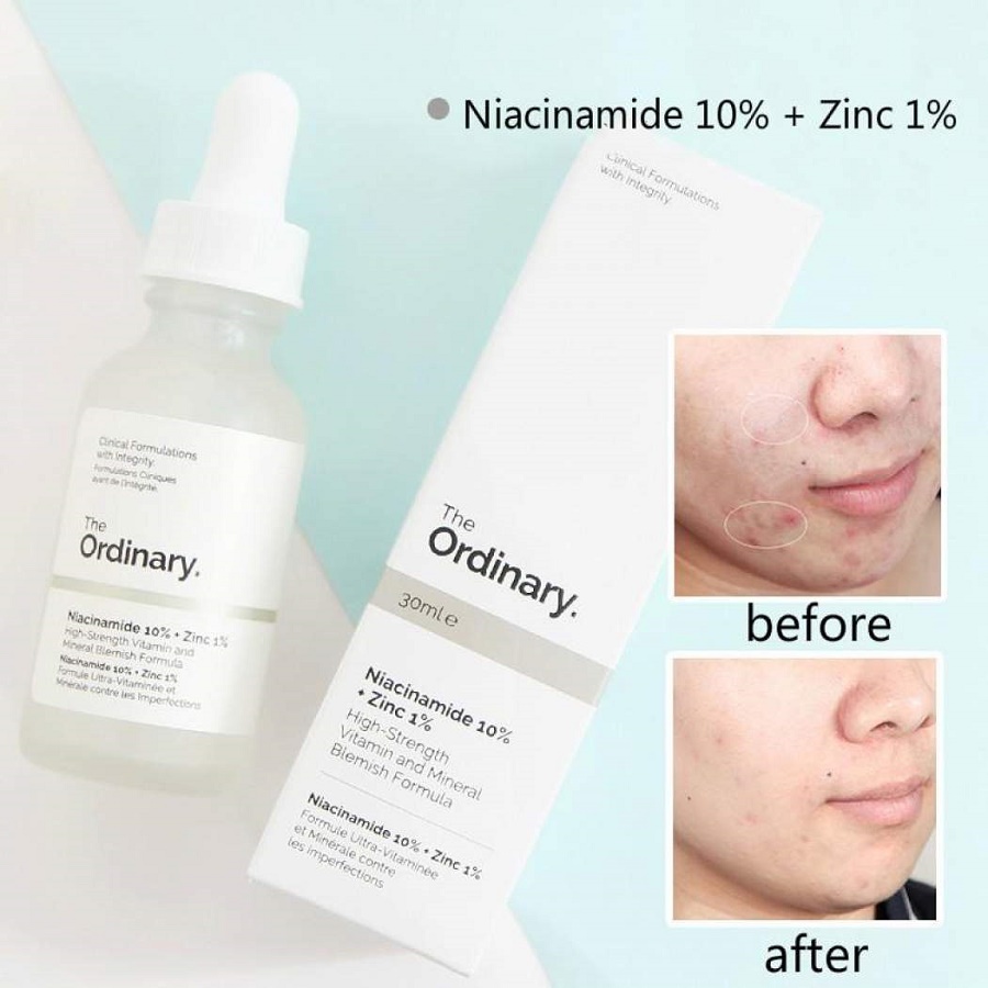 Tinh chất giảm mụn và vết thâm, se khít lỗ chân lông, trắng sáng da The Ordinary Niacinamide 10% + Zinc 1% (30ml) + Tặng 1 mặt nạ sủi bọt Su:m 37 Đen