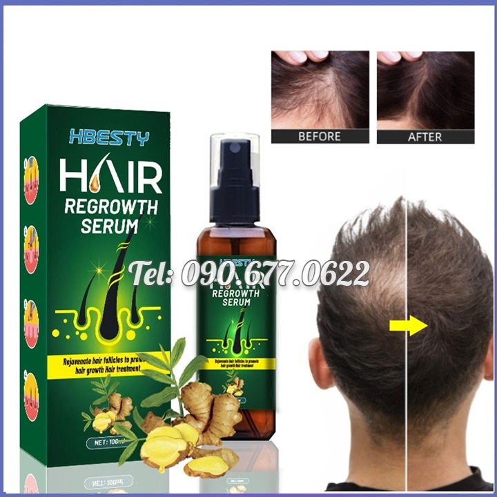 Serum dưỡng kích mọc tóc, giúp tóc mọc nhanh, mọc nhiều và dày, sợi tóc đen bóng xuất xứ Nhật Bản – Mã số 1230