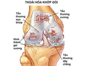 Viên dưỡng khớp Joint Max - Liệu trình 5 hộp 3 Viên dưỡng khớp Joint Max - Liệu trình 5 hộp 3