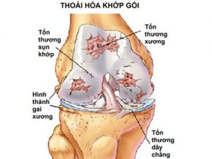 Viên dưỡng khớp Joint Max - Liệu trình 4 hộp 3