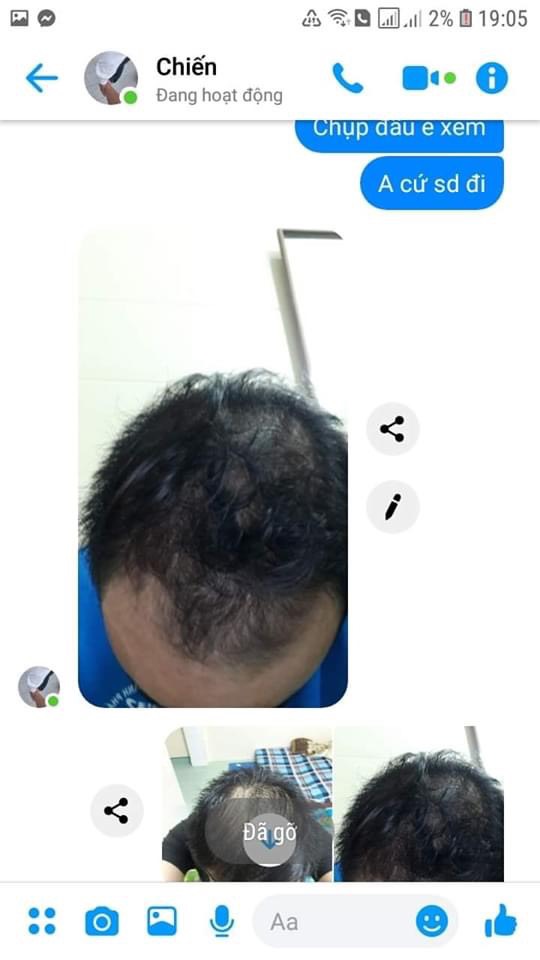TINH DẦU DƯỠNG TÓC HƯƠNG BƯỞI