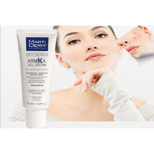 Kem Dưỡng Phục Hồi Da, Chống Nắng, Mờ Thâm Sẹo MartiDerm Skin Repair Arnika Gel Cream FPS/SPF 30