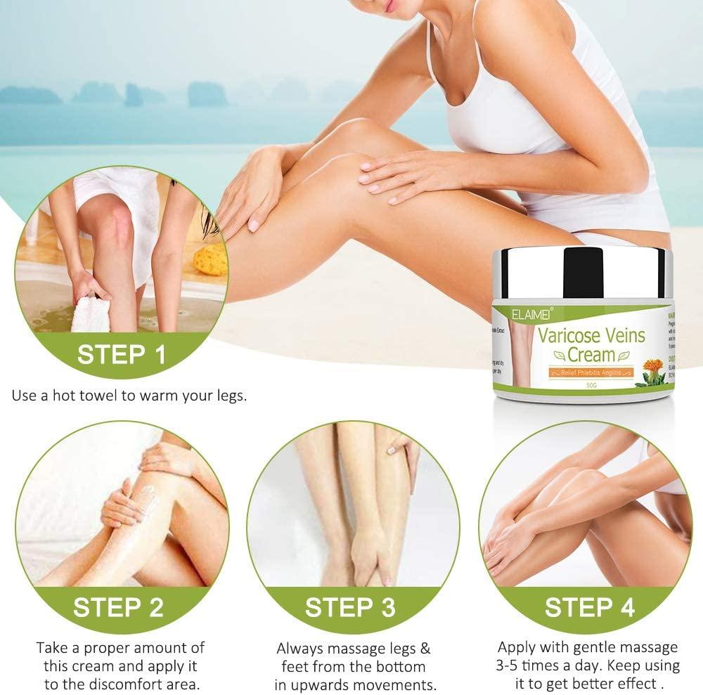 Kem tĩnh mạch giãn tĩnh mạch 50g Kem tĩnh mạch so với tĩnh mạch nhện, tĩnh mạch giãn tĩnh mạch và tĩnh mạch nhện, tĩnh mạch giãn, thuốc mỡ chăm sóc chân