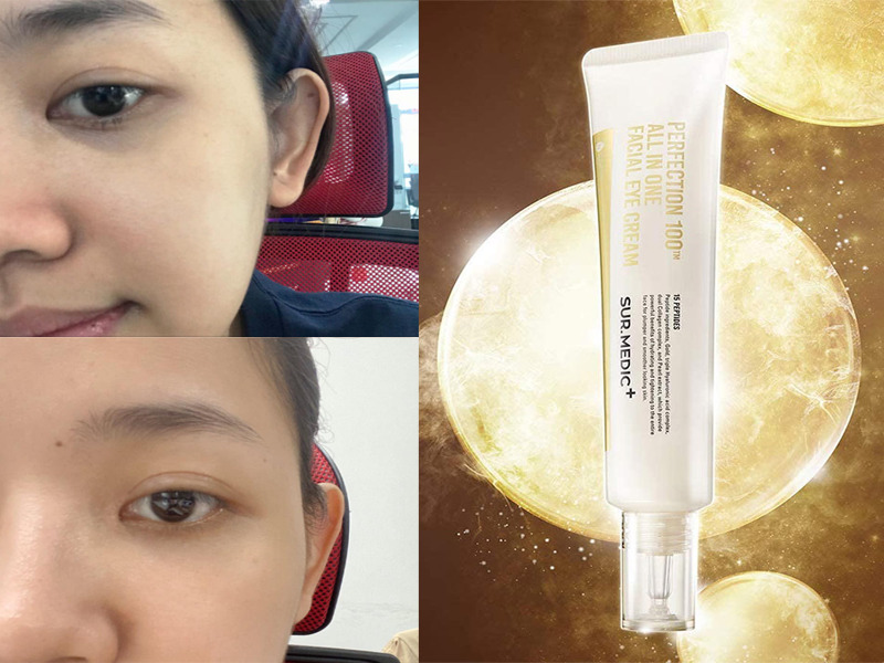 Kem Giảm Thâm Mắt Xoá Mờ Nếp Nhăn SURMEDIC Perfection 100tm All In One Facial Eye Cream 35ml