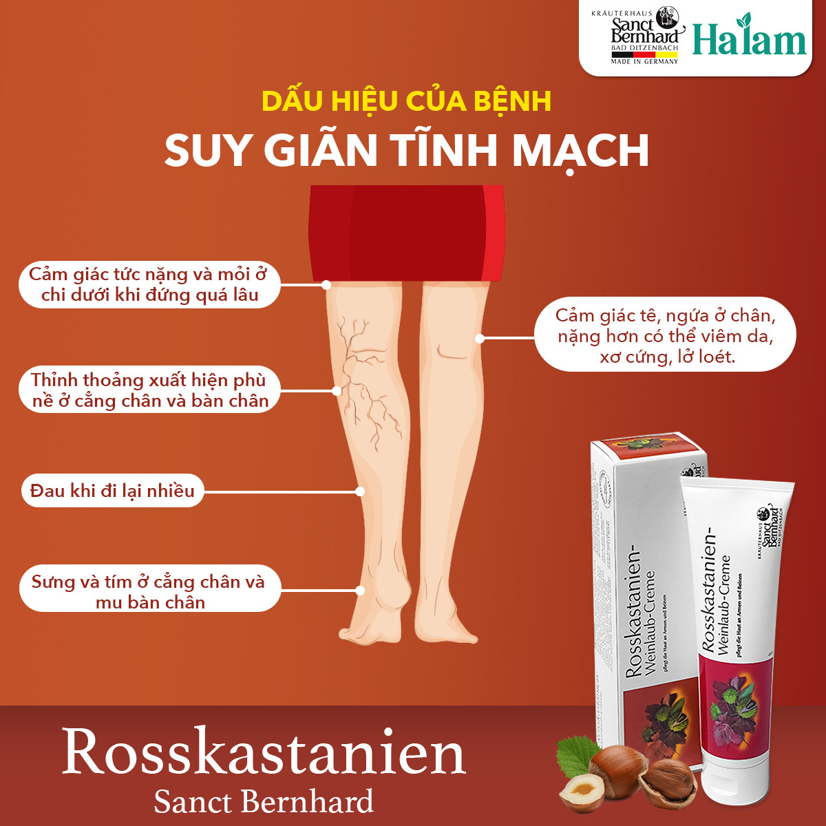 Kem bôi suy giãn tĩnh mạch Rosskastanien hạt dẻ ngựa giảm đau, tuần hoàn máu (tuýp 150ml)