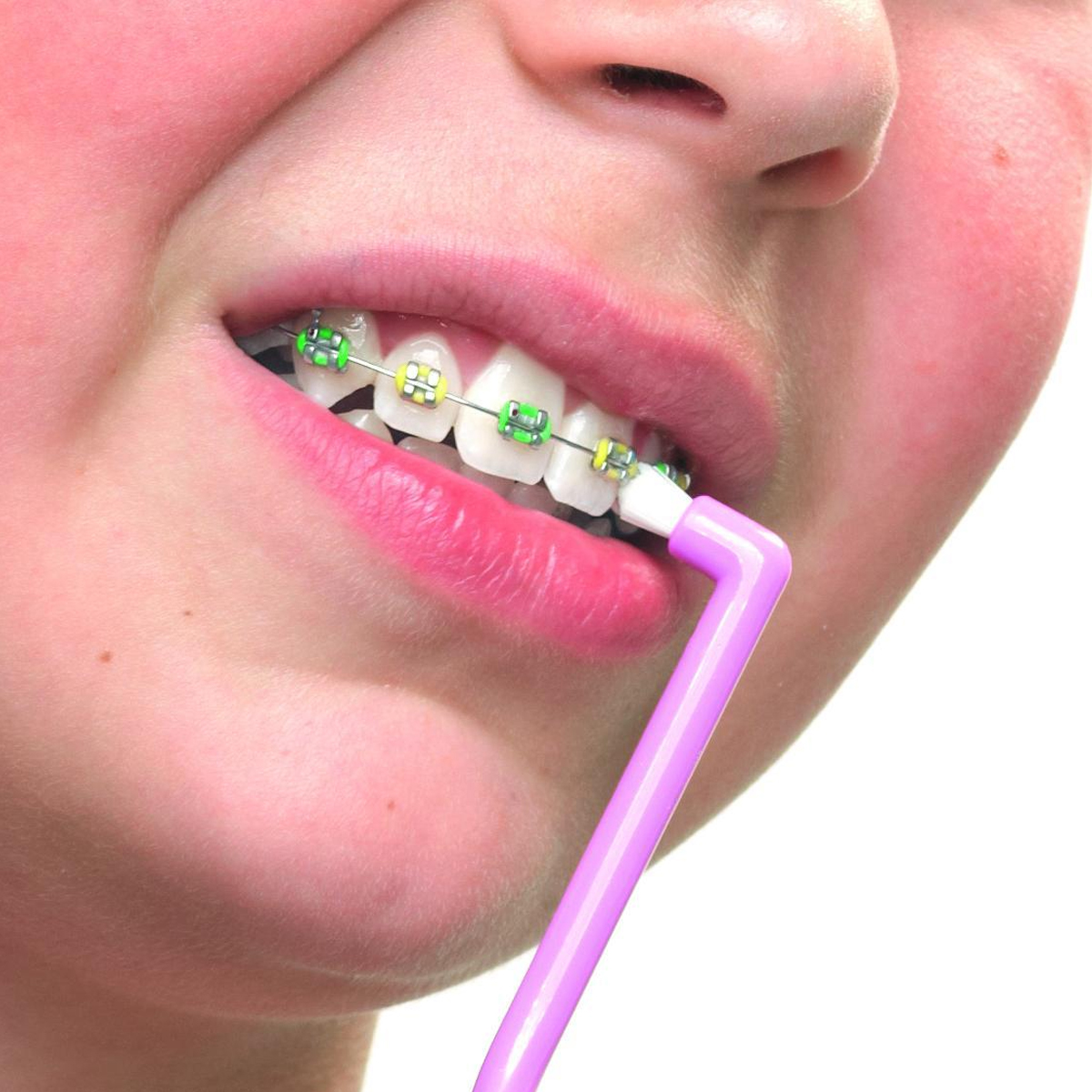 Bộ chăm sóc răng niềng Curaprox Ortho Kit