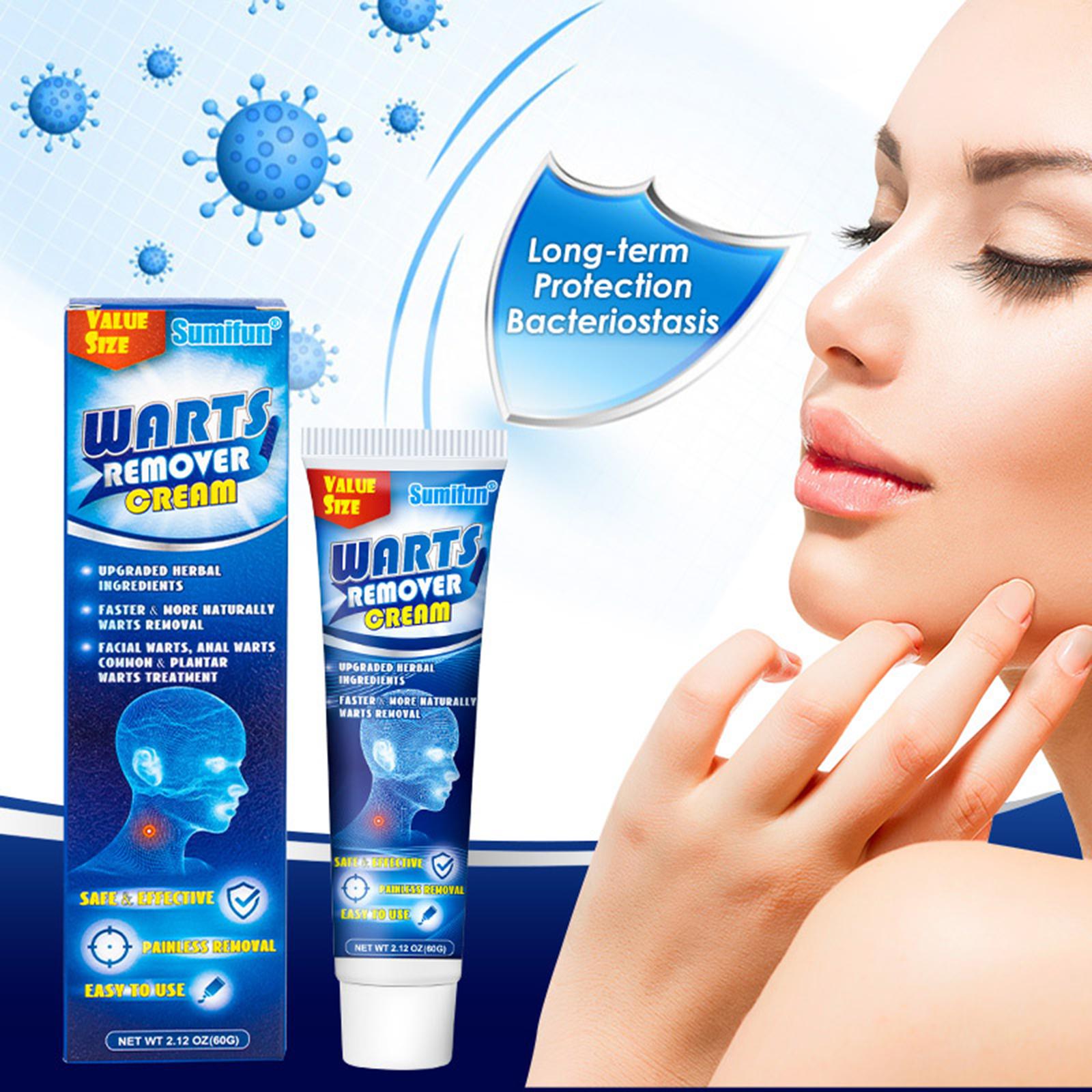 Wart soothing corns cream Ke wart cream