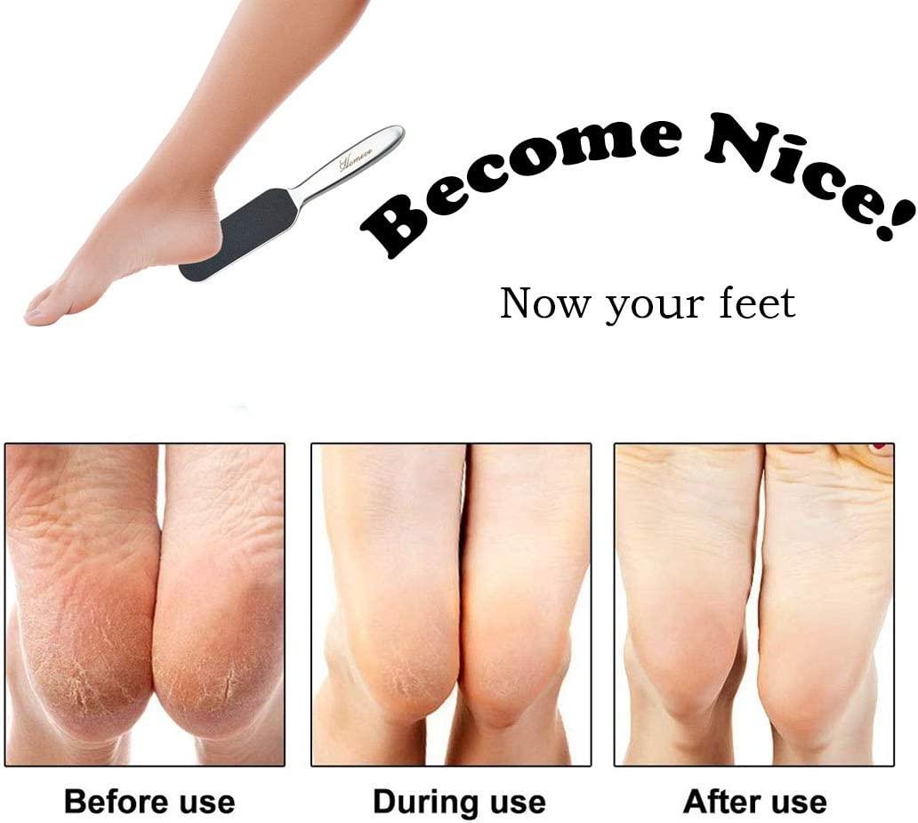 Professional Pedicure Foot File - Da nứt nẻ bằng thép không gỉ có thể tái sử dụng