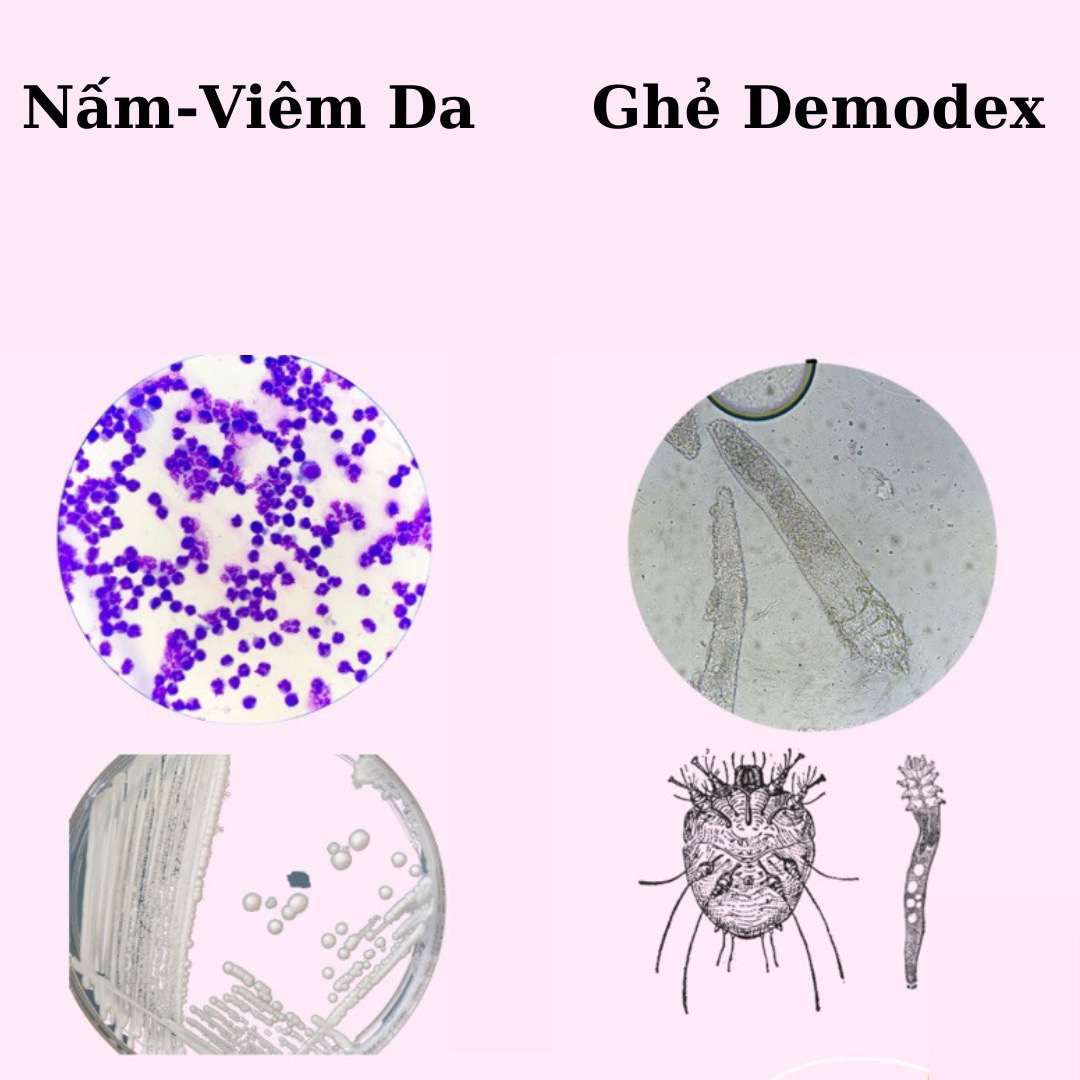 COMBO Viên ETO MODEX Sạch Ve, Ghẻ, Và Chai Xịt Nấm Ghẻ Nặng Thảo Dược Cho Chó Mèo, An Toàn Cho Thú Cưng