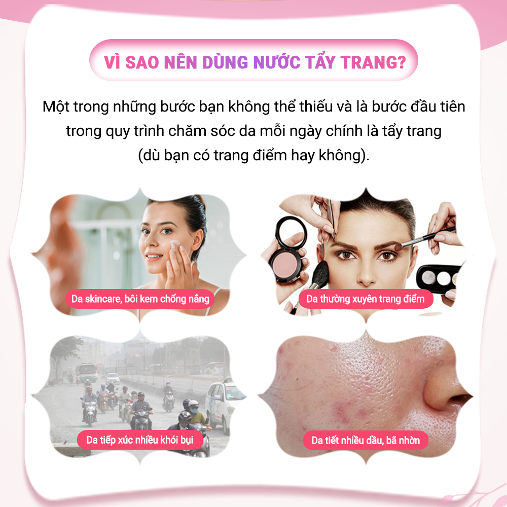 Nước tẩy trang hoa hồng KISS ON làm sạch sâu, cân bằng độ ẩm, thu nhỏ lỗ chân lông , nuôi dưỡng làn da mịn màng, sáng khỏe Kisson 145ml JN-KI-NTT01