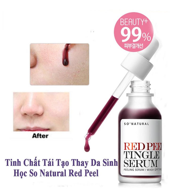 Tinh chất tái tạo da sinh học So Natural Red Peel Tingle Serum – Tái tạo da 35ml+ Tặng kèm 1 mặt nạ sủi bọt Su:m 37 Đen