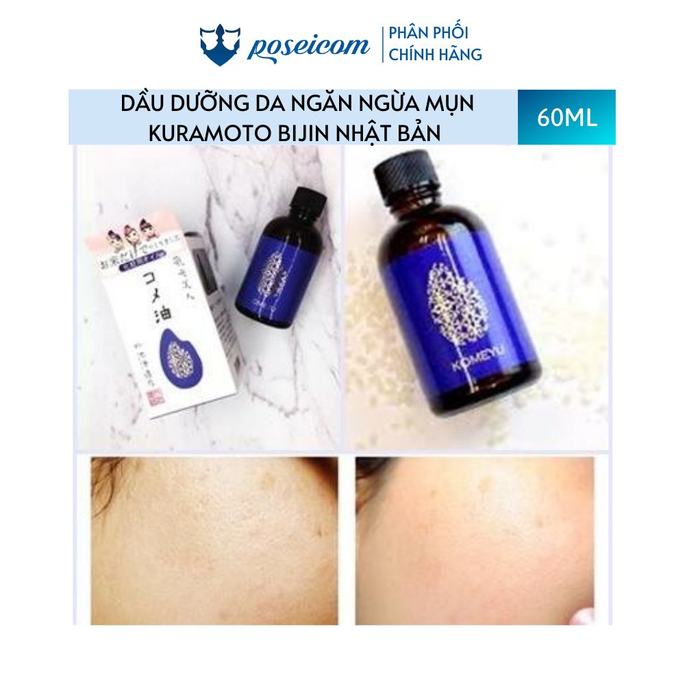 Serum Tinh Dầu Gạo Dưỡng Trắng Da Và Ngăn Ngừa Mụn Kuramoto Bijin Rice Beauty Oil 60ML Poseicom 4992969002941